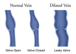 normal_vs_dilated2